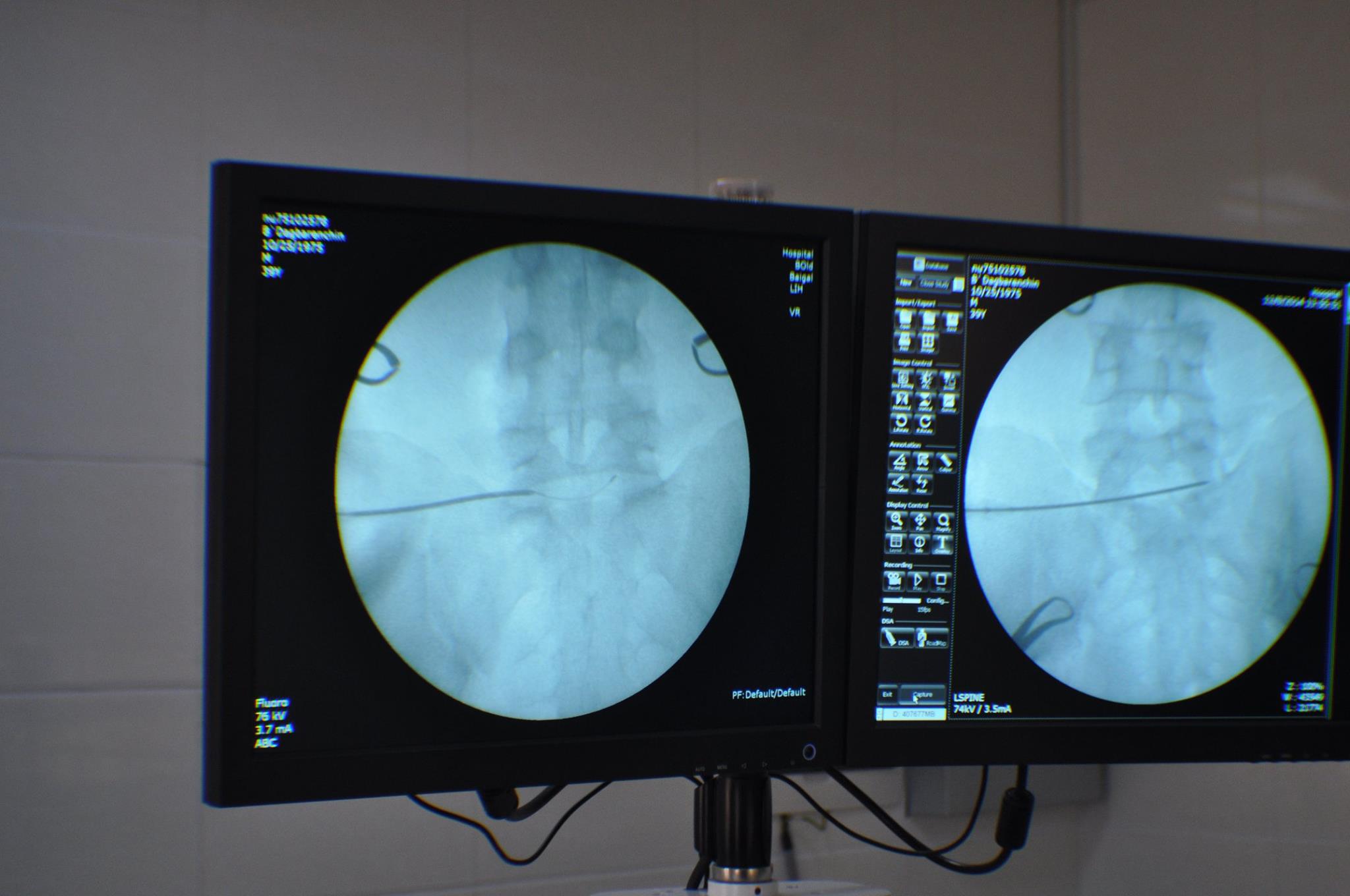 Нуруу нугасны хагалгааны шинэ үе “Топаз” эмнэлэгт нэвтэрлээ